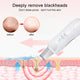 Ultrasonic Skin Scrubber Deep Face Cleaning Machine Peeling Shovel Facial Pore Cleaner Face Skin Scrubber Lift Beauty Instrument Ultrasonic Facial Scrubber Pore Blackhead Remover Spatula Deep Skin Spa